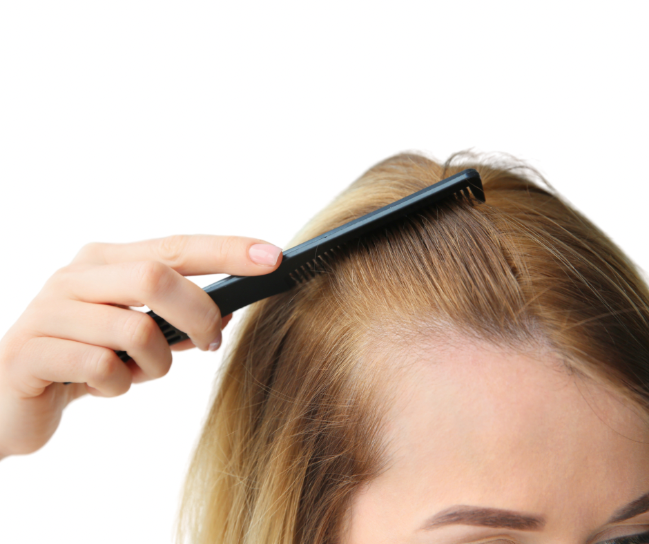 hairLoss