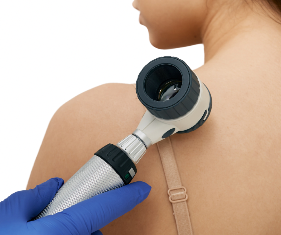 skinCancer